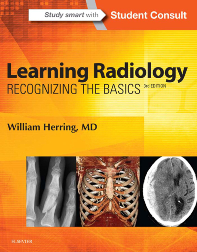 Learning Radiology: Recognizing The Basics / William Herring Fotokopinci -